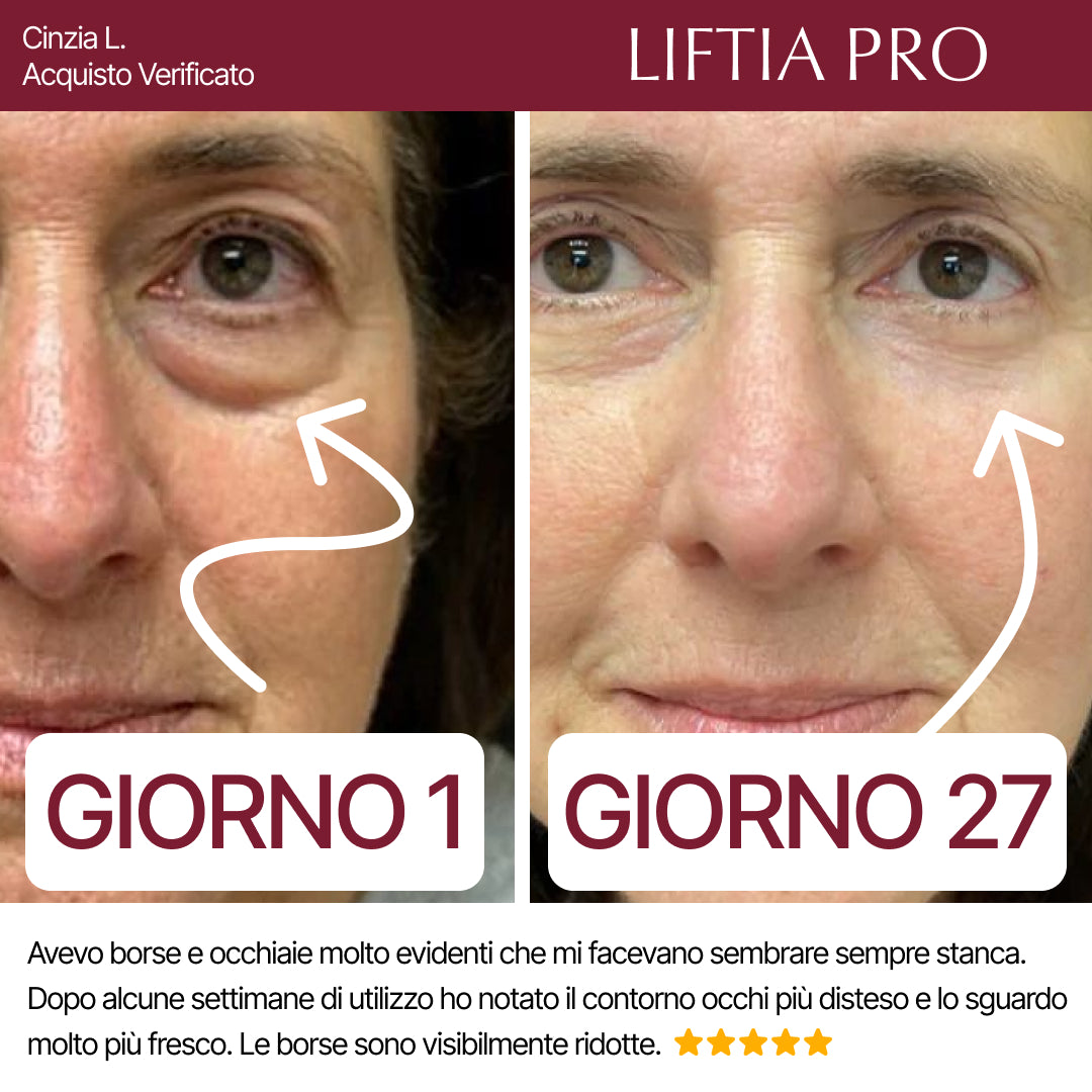 LIFTIA PRO - Skincare per ringiovanire lo sguardo